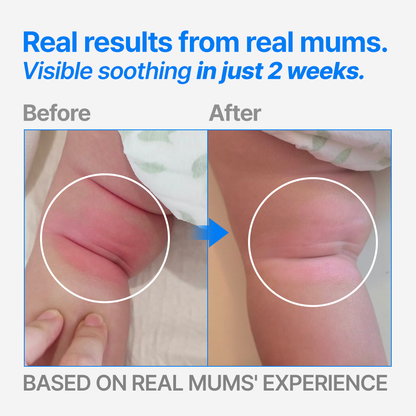 Lesstopy ATO Cream for Infants, Organic Sensitive Skin Moisturizer